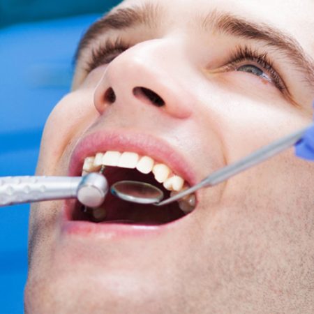cirugia-dental